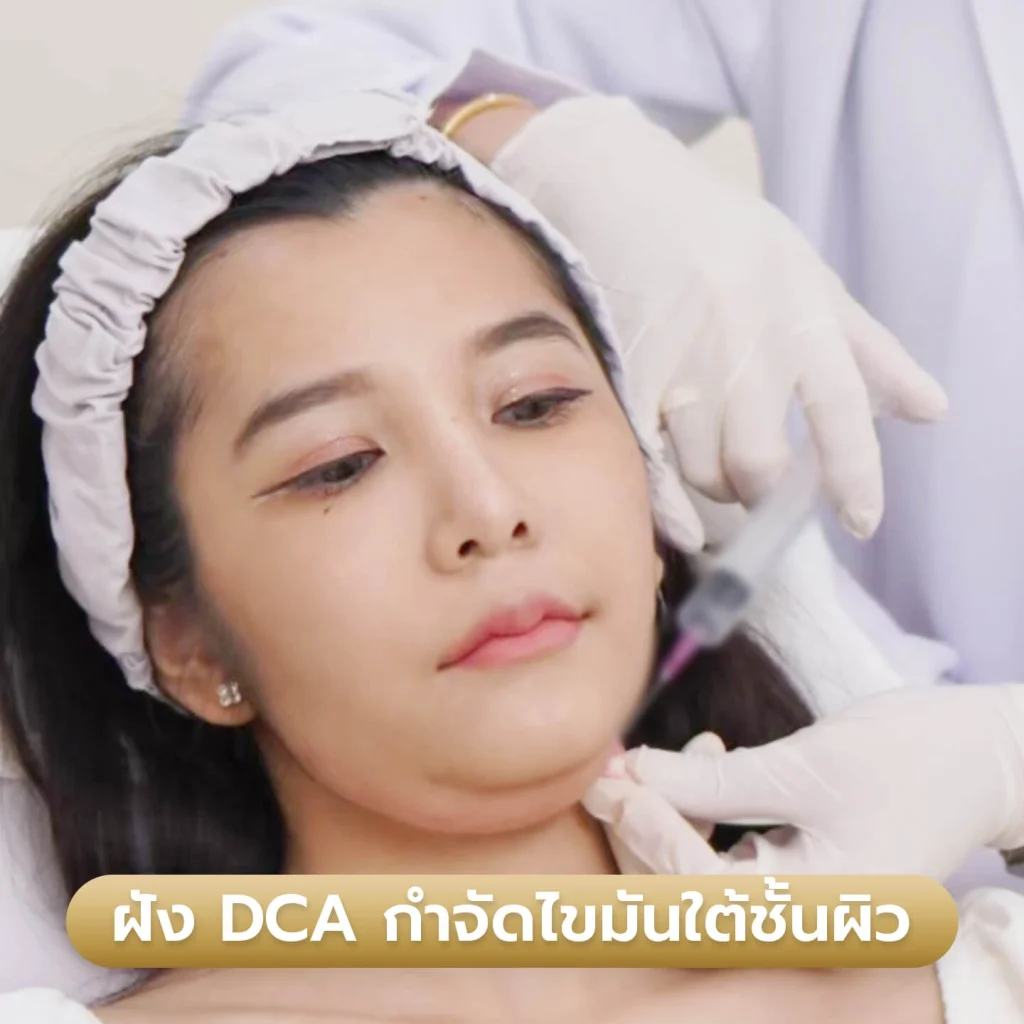 บริการ DCA