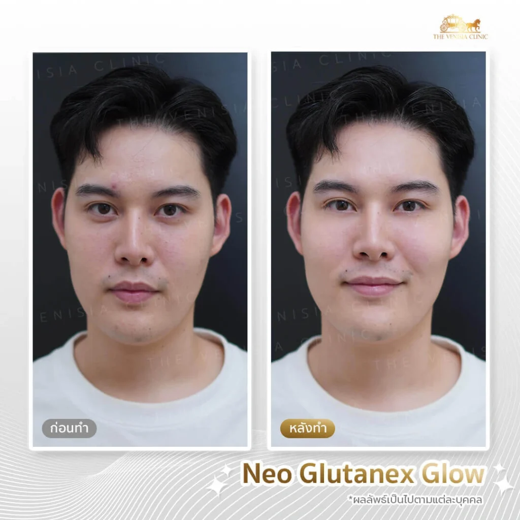 ทําหน้าใสให้ผิวดูชุ่มชื้น มีออร่าด้วยนวัตกรรมจากเกาหลี