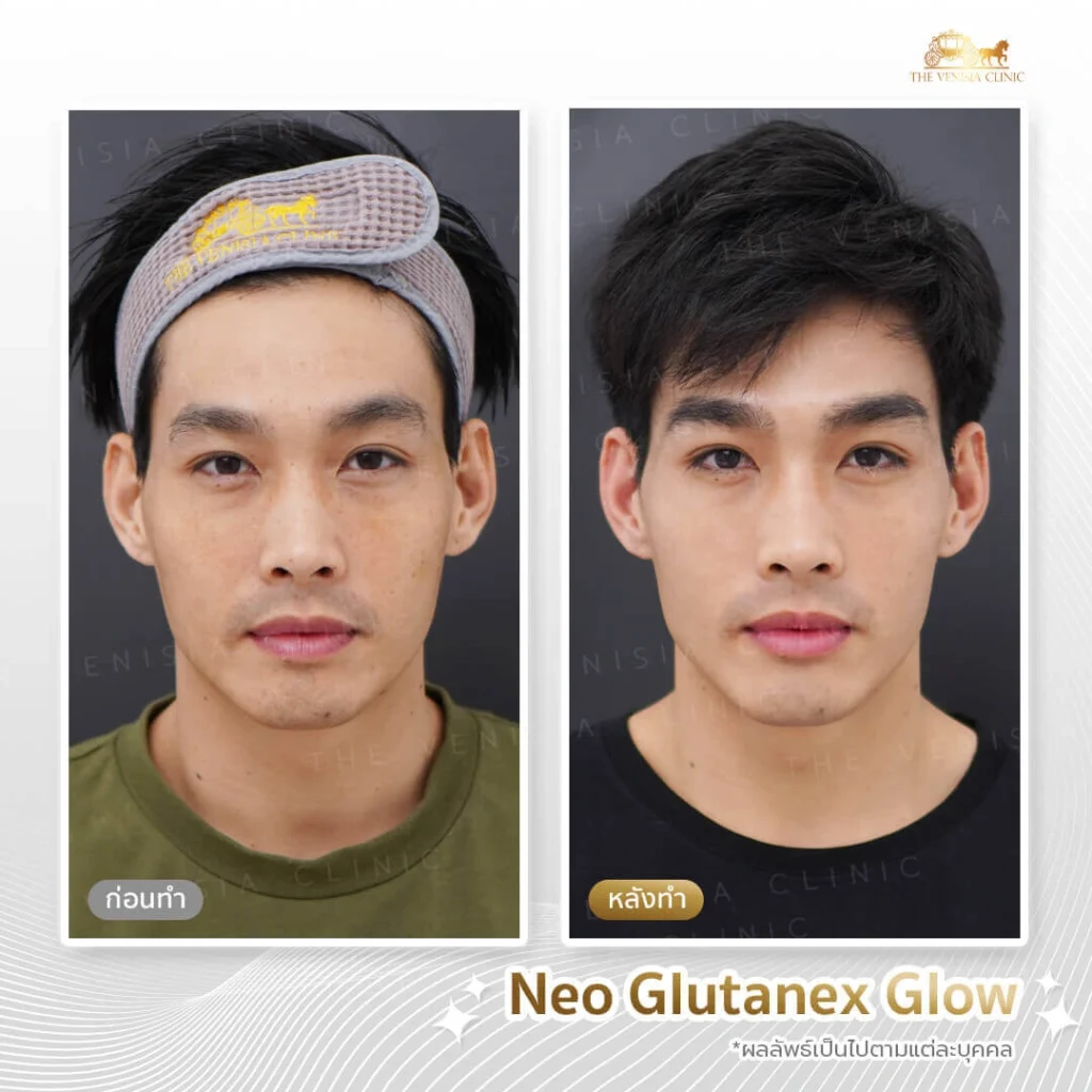 คอร์สหน้าใสสำหรับผู้ชาย ปรับผิวให้ดูสดใสขึ้นอย่างเห็นผล