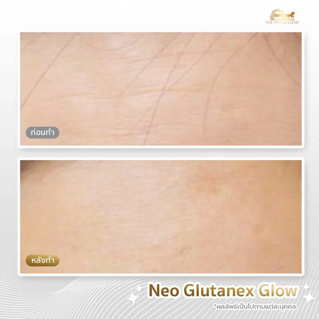 ผิวแห้งกร้านกลับมาชุ่มชื้น ด้วยคอร์สหน้าใสที่ The Venisia Clinic