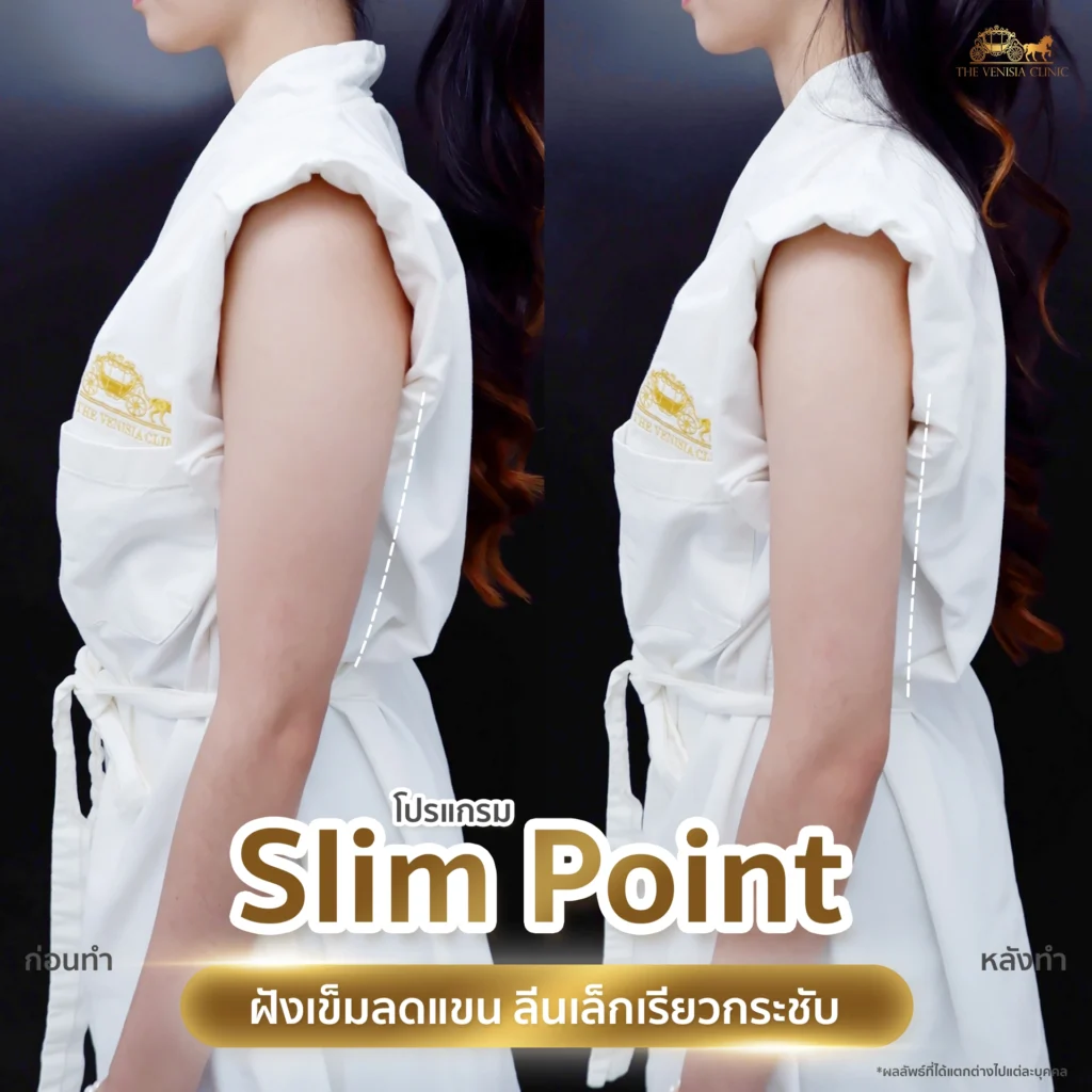ลดต้นแขน ผู้หญิง แขนหายย้อย กระชับทันที