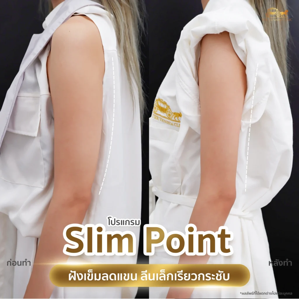รีวิว ลดต้นแขน แบบไม่เจ็บ เห็นผลหลังทำครั้งแรก