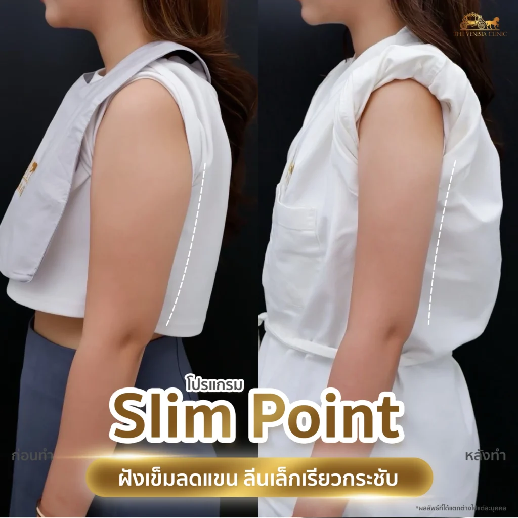 เปรียบเทียบต้นแขนซ้าย–ขวา เห็นผลชัดเจน