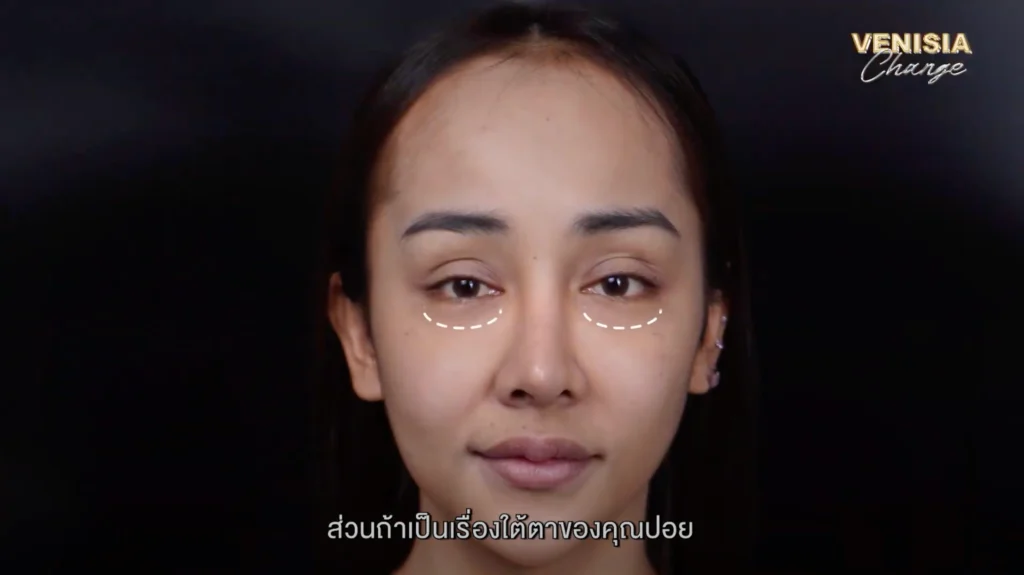 ใต้ตาคล้ำและถุงใต้ตาที่ทำให้คุณปอยขาดความมั่นใจ ต้องหาวิธีแก้ไขอย่างจริงจัง