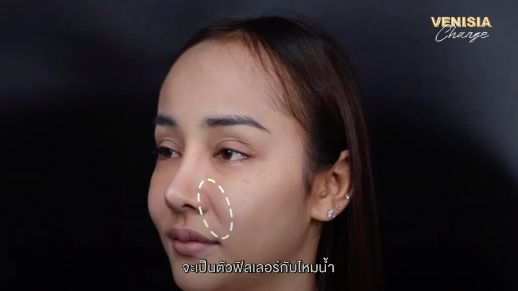ปัญหาใต้ตาคล้ำและร่องแก้มลึกสะสมจากการทำงานกลางคืน