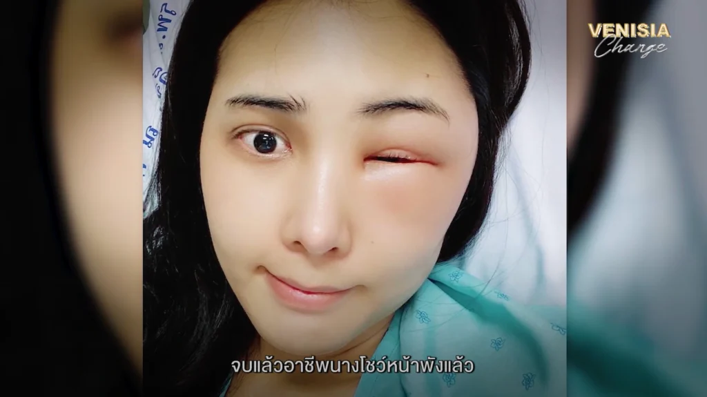 คุณตูนเล่าบทเรียนราคาแพงจากประสบการณ์ใช้บริการ "หมอกระเป๋า" ที่ไม่ได้มาตรฐาน ซึ่งเกือบทำให้ใบหน้าพัง