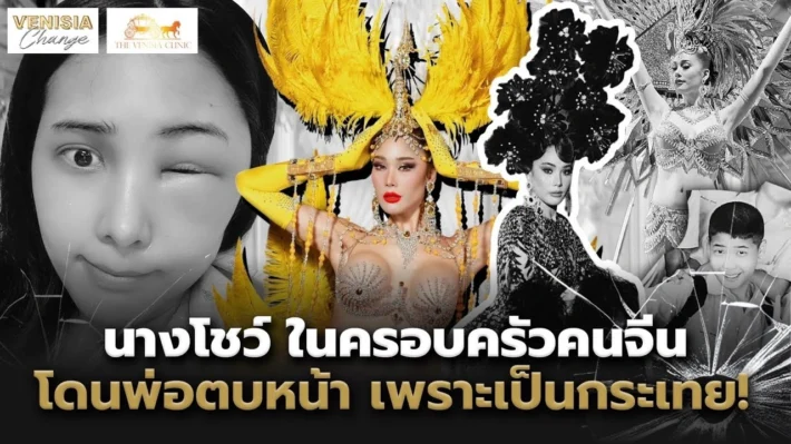 คุณตูน นางโชว์จากพัทยา ในลุคสวยมั่นใจหลังทำ ฟิลเลอร์ปาก ที่ The Venisia Clinic