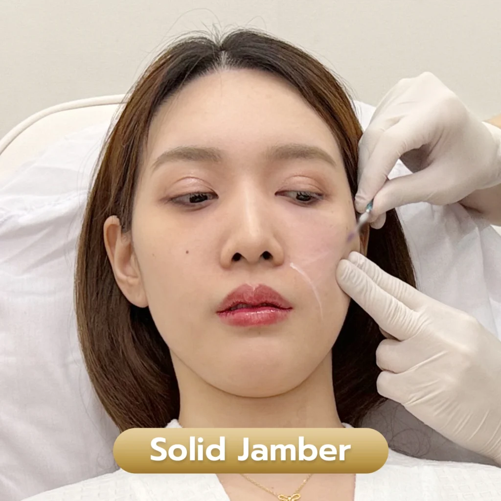 บริการ Solid Jamber