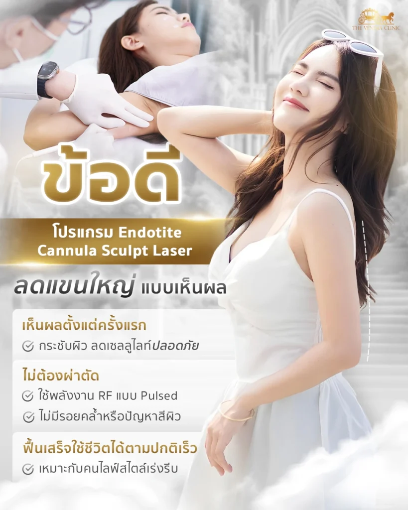 ข้อดีของโปรแกรม Endotite Cannula Sculpt Laser ช่วยลดต้นแขนโดยไม่ต้องผ่าตัด เห็นผลเร็ว