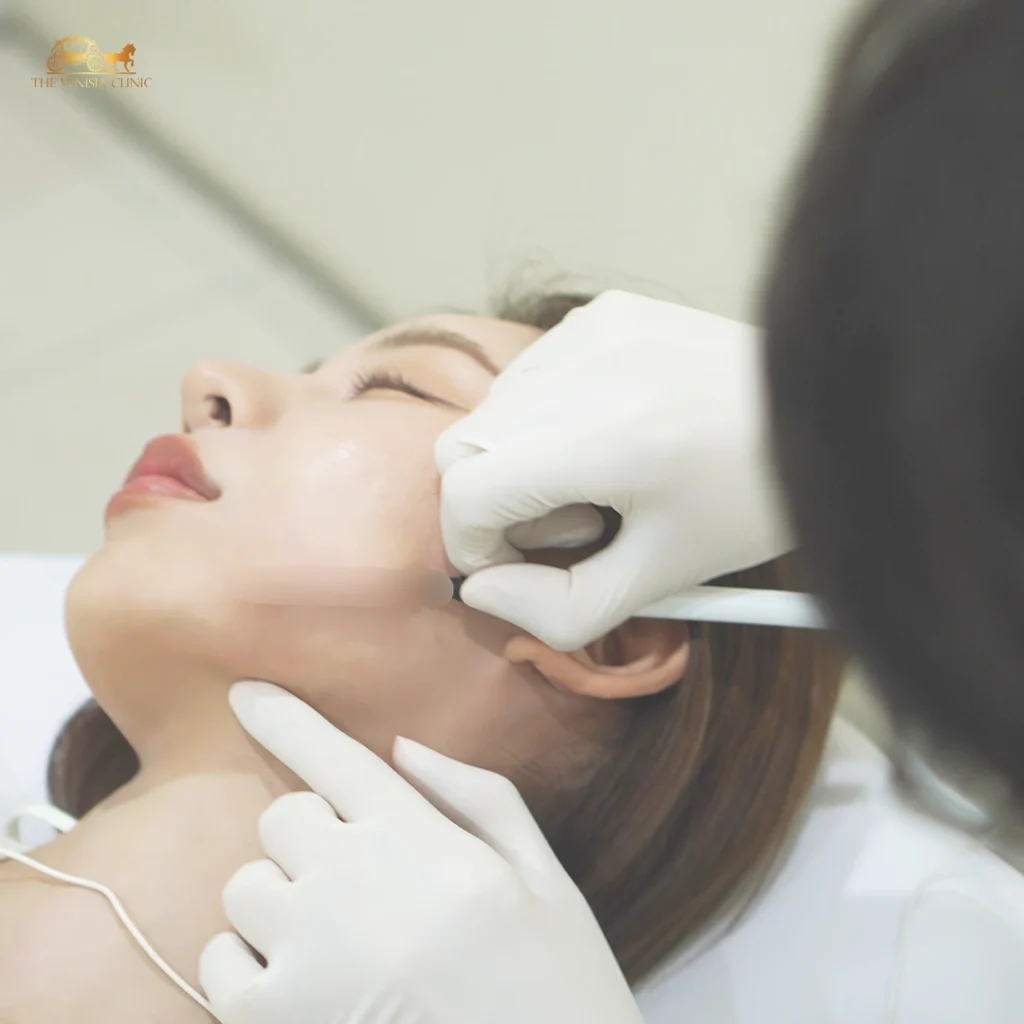 ภาพแพทย์ผู้เชี่ยวชาญกำลังใช้ Endotite Cannula Lifting Laser เพื่อ ยกกระชับหน้า