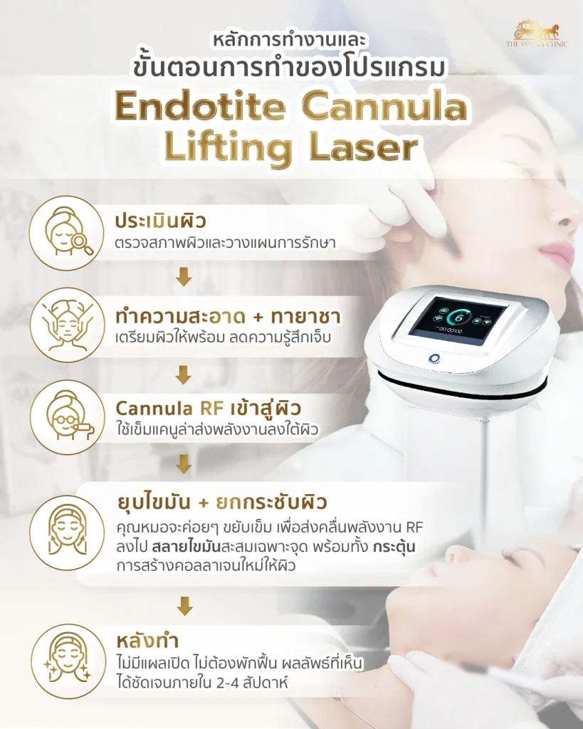 หลักการทำงานและขั้นตอนการทำ Endotite Cannula Lifting Laser เพื่อ ยกกระชับหน้า เห็นผลไว